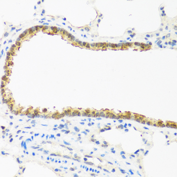 Anti-CDKN2C Rabbit pAb