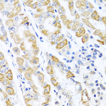 Anti-CDKN2C Rabbit pAb