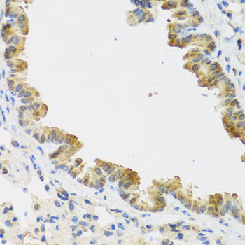 Anti-CDKN2C Rabbit pAb