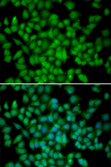 Anti-CDKN2C Rabbit pAb