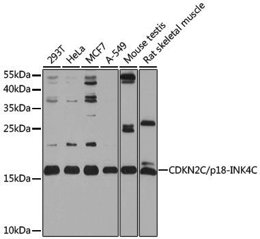 Anti-CDKN2C Rabbit pAb