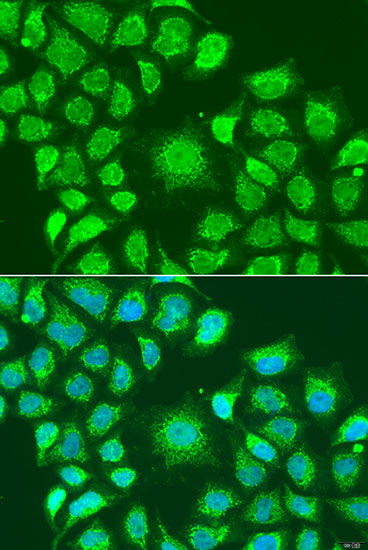 Anti-ATG4D Rabbit pAb