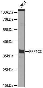 Anti-PP1C gamma Rabbit pAb