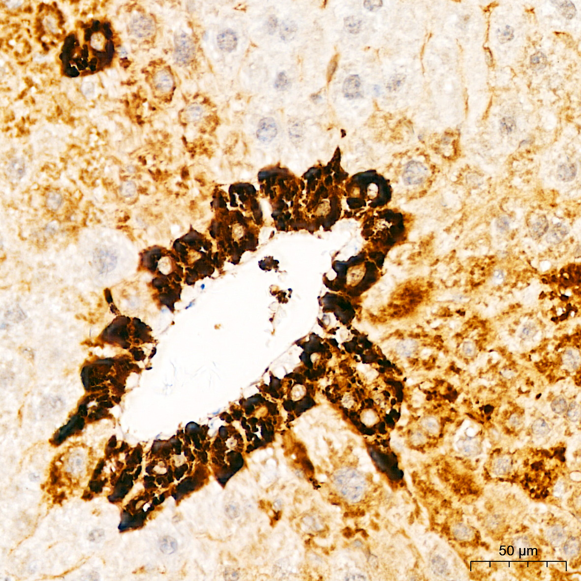 Anti-Glutamine Synthetase Rabbit pAb