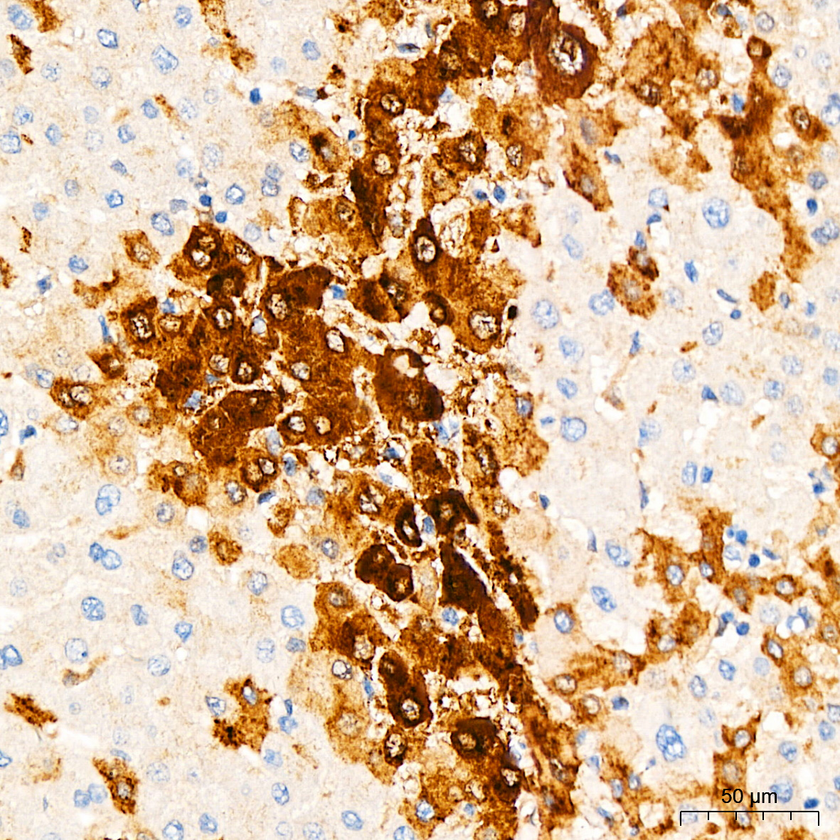 Anti-Glutamine Synthetase Rabbit pAb