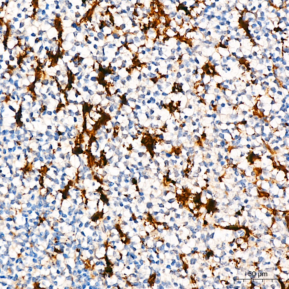Anti-Glutamine Synthetase Rabbit pAb
