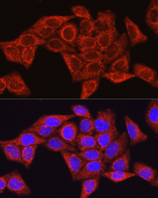 Anti-Glutamine Synthetase Rabbit pAb