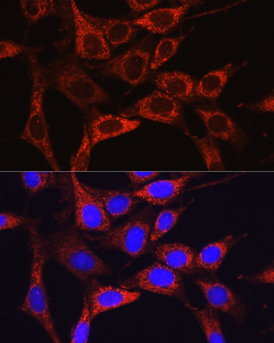 Anti-Glutamine Synthetase Rabbit pAb