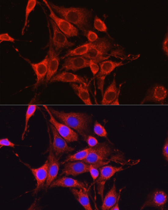 Anti-Glutamine Synthetase Rabbit pAb