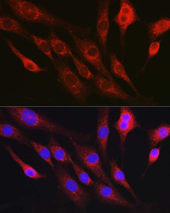 Anti-Rho A/B/C Rabbit pAb