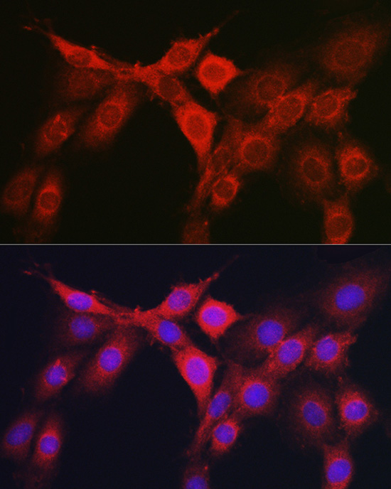 Anti-Rho A/B/C Rabbit pAb