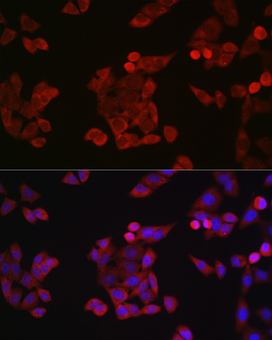 Anti-Cyclin B1 Rabbit pAb