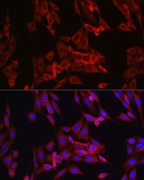 Anti-Cyclin B1 Rabbit pAb