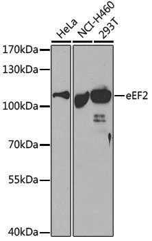 Anti-Elongation factor 2 Rabbit pAb