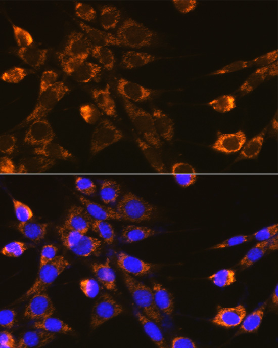 Anti-Integrin beta 1 Rabbit pAb