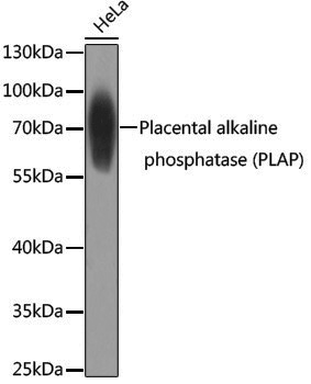 Anti-Placental Alkaline Phosphatase Rabbit pAb