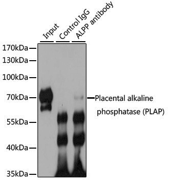 Anti-Placental Alkaline Phosphatase Rabbit pAb