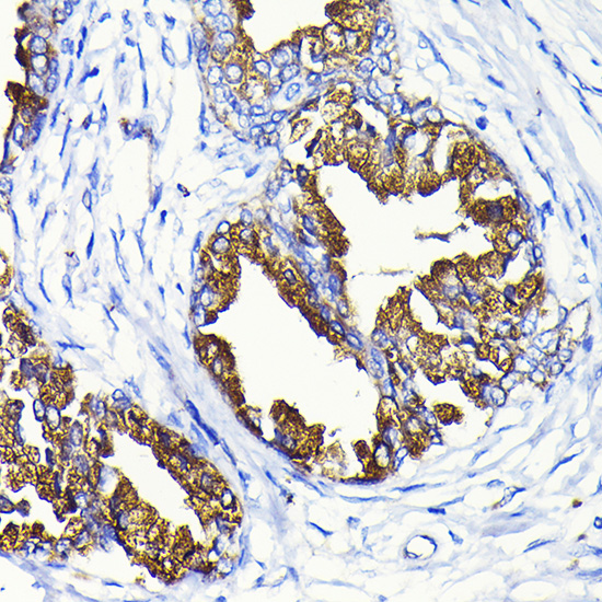 Anti-Prostate Specific Antigen Rabbit pAb