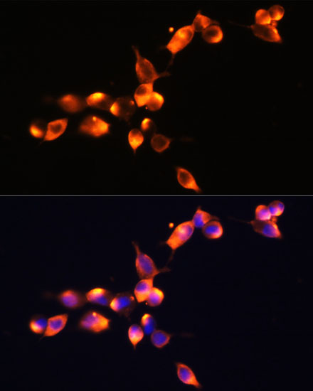 Anti-Prostate Specific Antigen Rabbit pAb