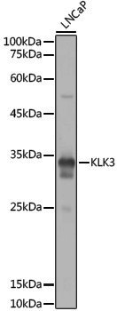 Anti-Prostate Specific Antigen Rabbit pAb