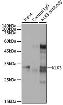 Anti-Prostate Specific Antigen Rabbit pAb