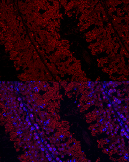 [KD Validated] Anti-Glutathione Peroxidase 4 Rabbit pAb