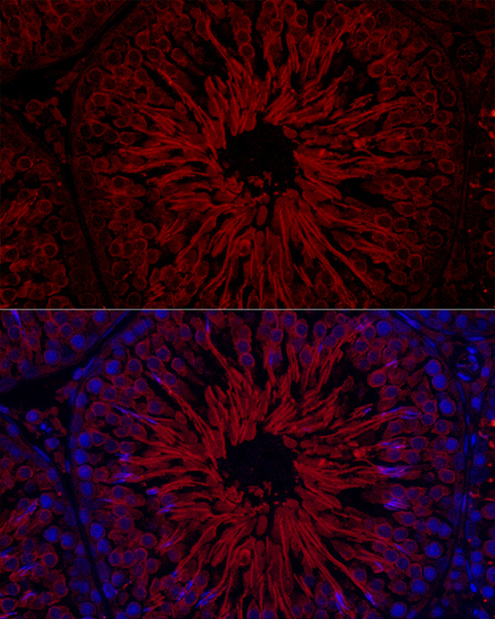[KD Validated] Anti-Glutathione Peroxidase 4 Rabbit pAb