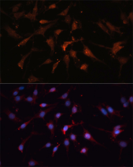 Anti-GSK3 beta Rabbit pAb