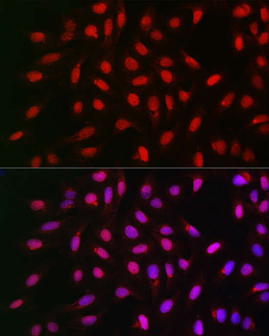 Anti-PP1C alpha Rabbit pAb