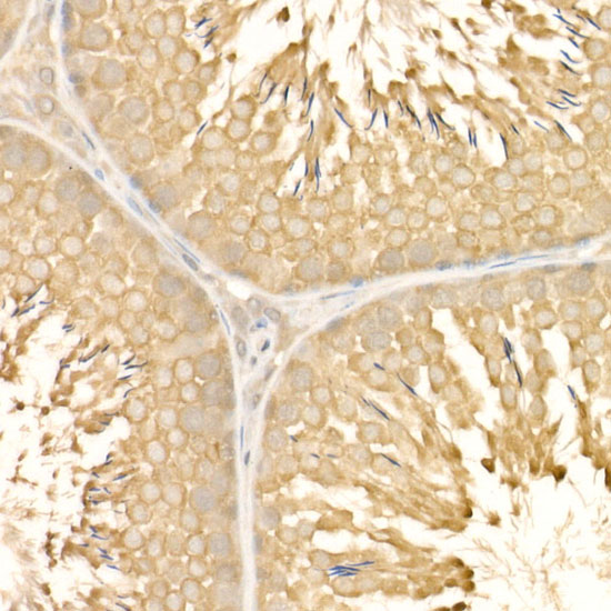 [KD Validated] Anti-eIF4E Rabbit pAb