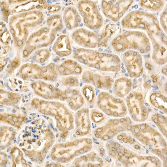 [KD Validated] Anti-eIF4E Rabbit pAb