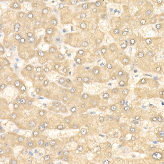 [KD Validated] Anti-eIF4E Rabbit pAb