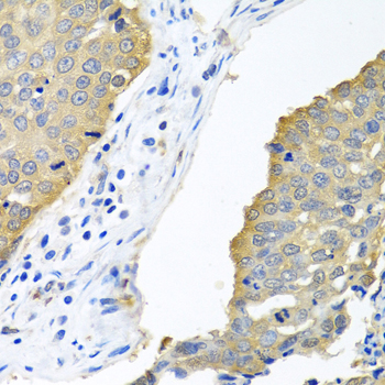 [KD Validated] Anti-eIF4E Rabbit pAb