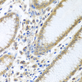 [KD Validated] Anti-eIF4E Rabbit pAb