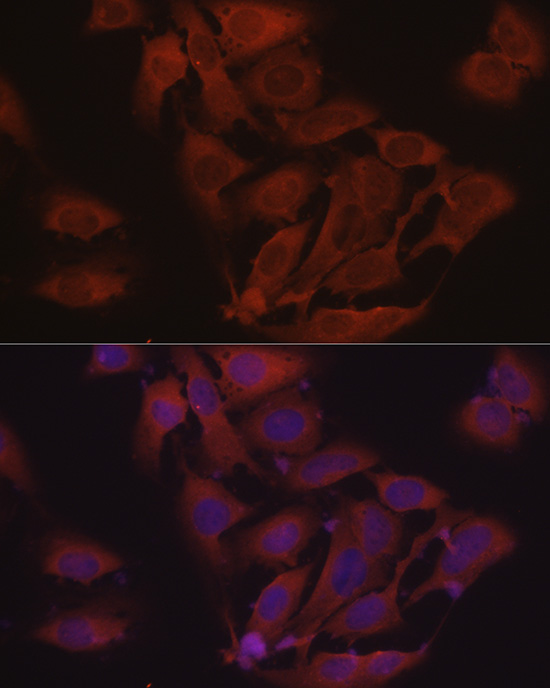 [KD Validated] Anti-eIF4E Rabbit pAb