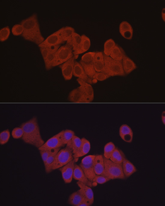 [KD Validated] Anti-eIF4E Rabbit pAb