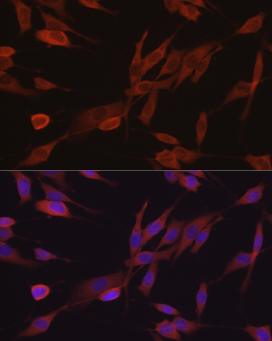 [KD Validated] Anti-eIF4E Rabbit pAb