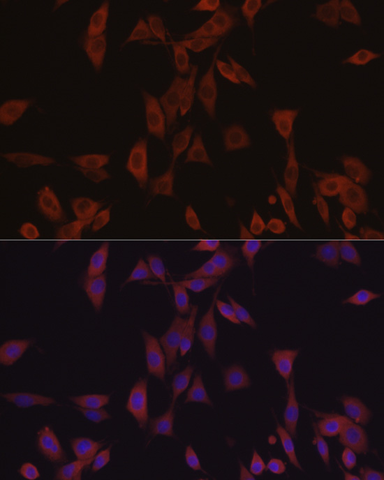 [KD Validated] Anti-eIF4E Rabbit pAb