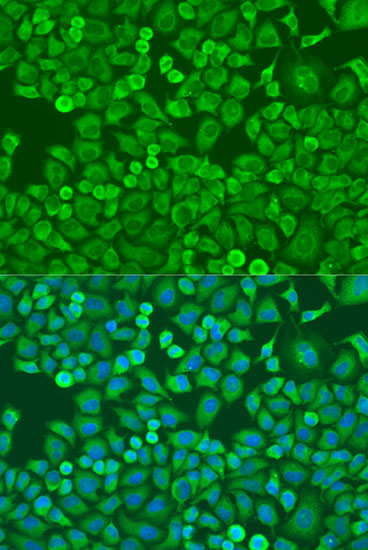 [KD Validated] Anti-eIF4E Rabbit pAb