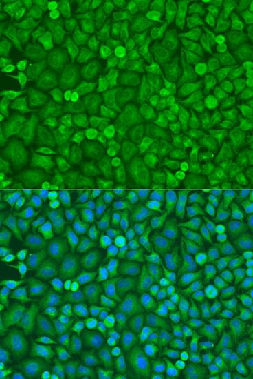 [KD Validated] Anti-eIF4E Rabbit pAb