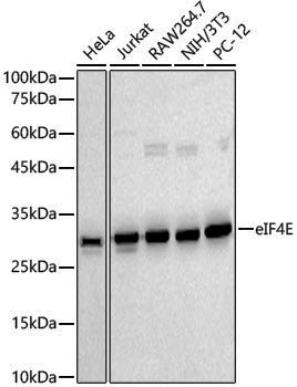 [KD Validated] Anti-eIF4E Rabbit pAb