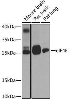 [KD Validated] Anti-eIF4E Rabbit pAb