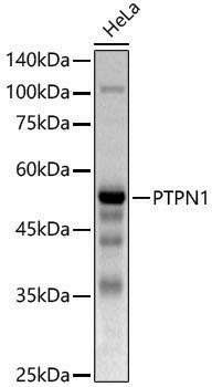 [KO Validated] Anti-PTP1B Rabbit pAb