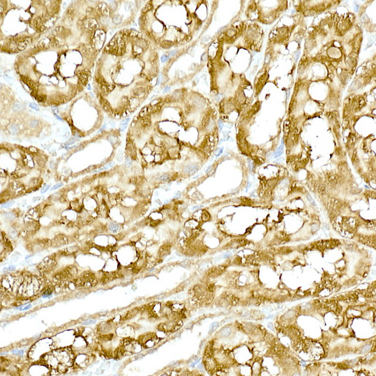 Anti-TBK1 Rabbit pAb