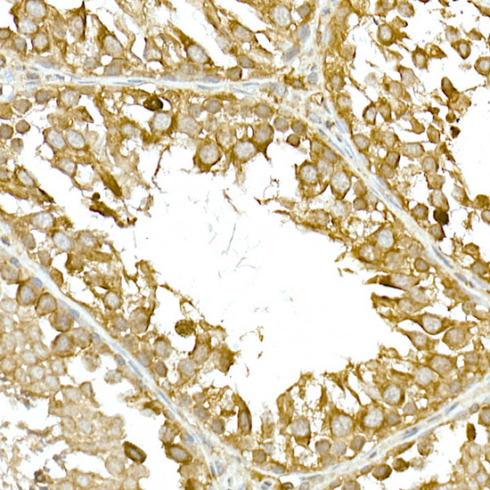 Anti-TBK1 Rabbit pAb