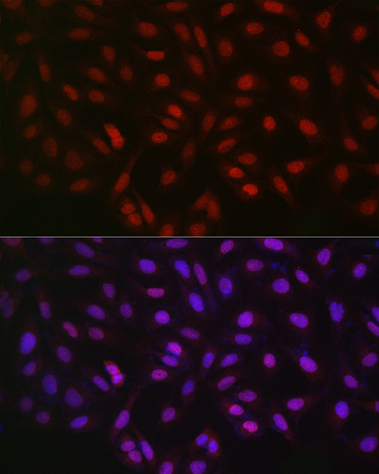 Anti-LKB1 Rabbit pAb