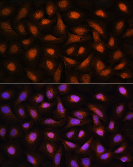 Anti-CTBP2 Rabbit pAb
