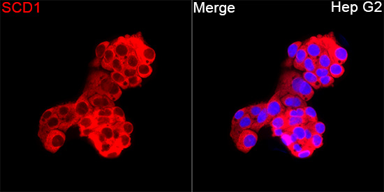 [KD Validated] Anti-SCD1 Rabbit pAb