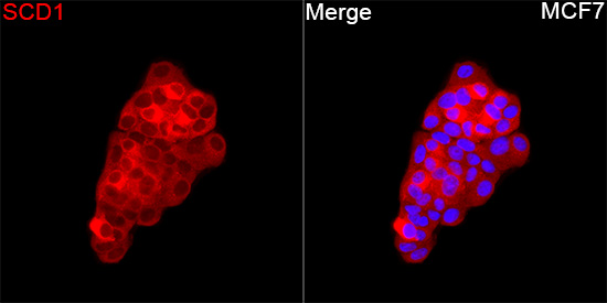[KD Validated] Anti-SCD1 Rabbit pAb