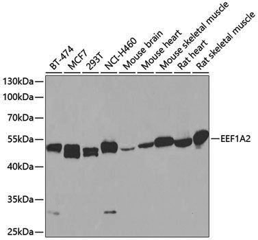 Anti-Elongation Factor 1A2 Rabbit pAb